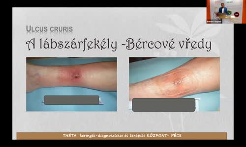 Přednáška MUDr Istvána Rozsose, cévního chirurga o terapii Bemer mp4