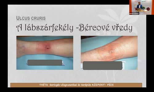 Přednáška MUDr Istvána Rozsose, cévního chirurga o terapii Bemer mp4